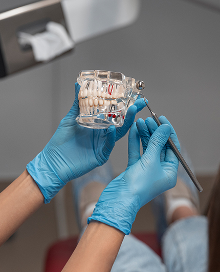 Root Canal Treatment- Dr Shilpa Godbole (Godbole Dental Clinic)