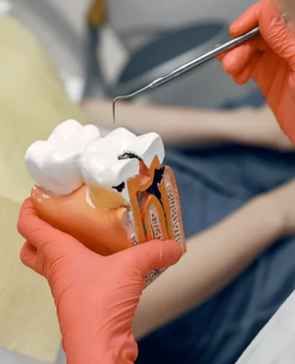 Dental Implants - Dr Shilpa Godbole (Godbole Dental Clinic)