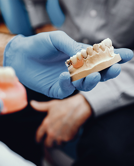 Tooth Bite Guard Godbole Dental Clinic